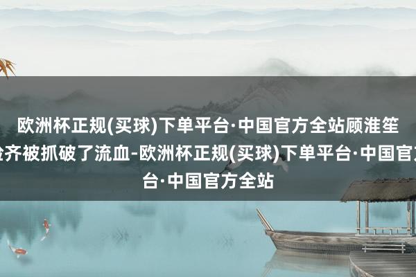 欧洲杯正规(买球)下单平台·中国官方全站顾淮笙见她脸齐被抓破了流血-欧洲杯正规(买球)下单平台·中国官方全站